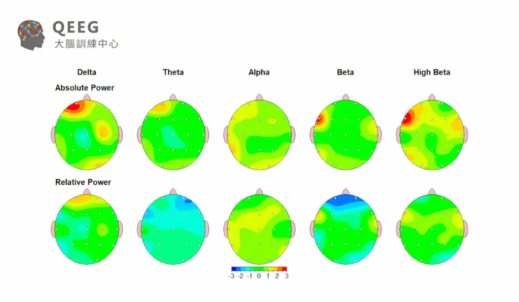 腦波影響你的意識與行為！四種腦波詳細介紹