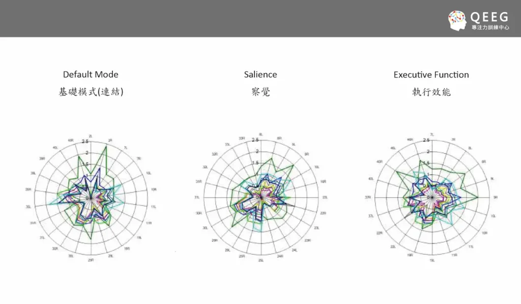 大腦後天再訓練！從掌管思想與意識的神經網絡改善
