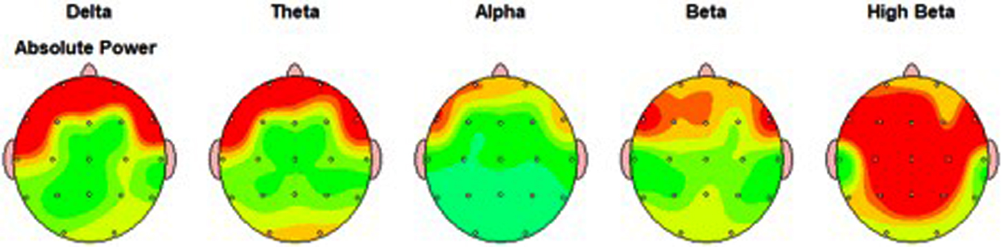 【腦效能專業檢測(6歲以上)】​